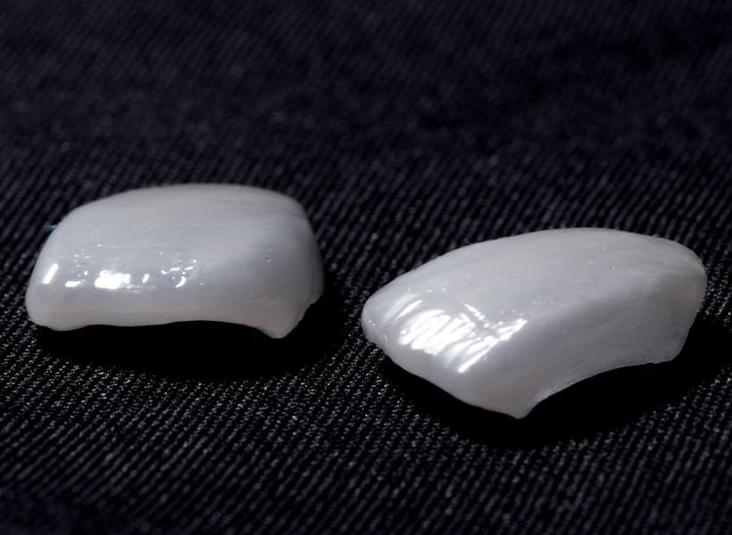 Disilicato de Litio IPS e.max de alta estética