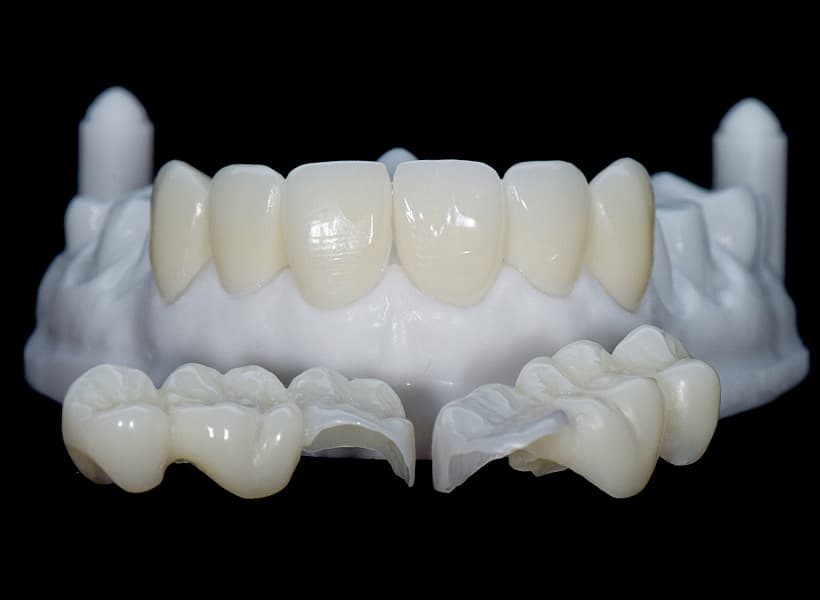 Asentamiento en modelo 3D impreso