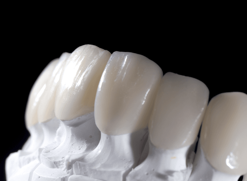 Ajuste oclusal y anatomía dental digital